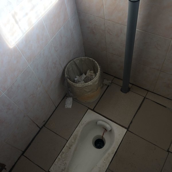 Мрт 11 больница рязань цена